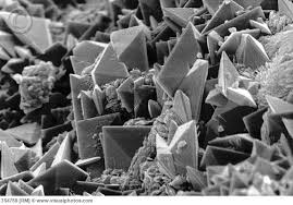 Sem Of Kidney Stone Climate Change Effects Scanning Electron Micrograph Things Under A Microscope