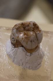 Maybe you would like to learn more about one of these? Denisovan Wikipedia