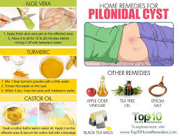 Home Remedies For Pilonidal Cysts Large Pimple At Bottom Of Tailbone Top 10 Home Remedies Pilonidal Cyst Natural Remedies For Allergies Allergy Remedies
