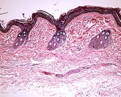 Image result for Acacia rovumae