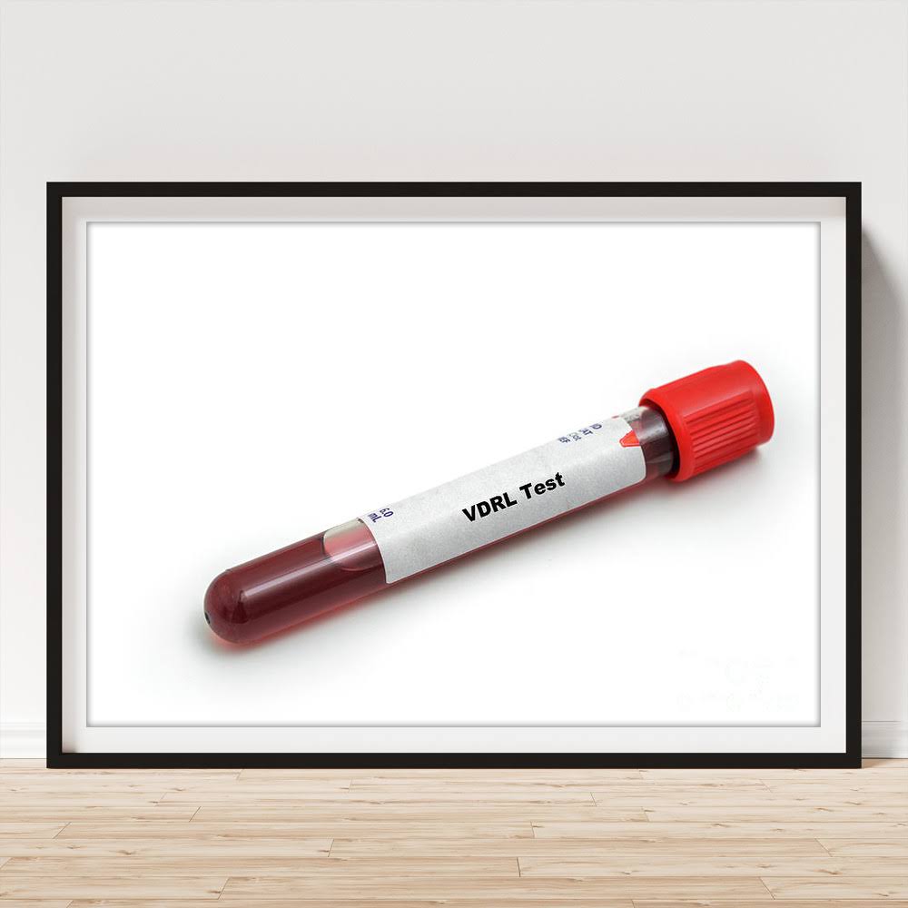 VDRL product image