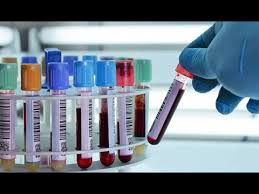 What is pcr (polymerase chain reaction) used for? Pcr ÙŠÙƒØ´Ù ÙÙŠØ±ÙˆØ³Ø§Øª Ø§Ù„Ø¯Ù… ÙˆÙƒÙˆØ±ÙˆÙ†Ø§ ÙƒÙ„ Ù…Ø§ ØªØ±ÙŠØ¯ Ù…Ø¹Ø±ÙØªÙ‡ Ø¹Ù† ØªØ­Ù„ÙŠÙ„ Youtube