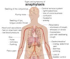 An itchy rash, throat or tongue swelling, shortness of breath, vomiting. Datei Signs And Symptoms Of Anaphylaxis Svg Wikipedia