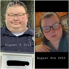 Im a week post opp. When did the bandages come off?