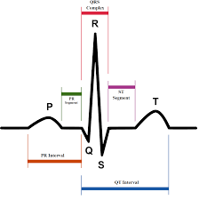 Review the ecg (ekg), present it according to the structure in ecg interpretation and attempt a diagnosis before clicking on the plus symbol to see the answer. Ekg Grunde Ablauf Auswertung Interpretation Praktischarzt