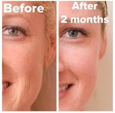 Dermatologist Created Skincare Products Rodan Fields Rodan And Fields Rodan And Fields Consultant Rodan And Fields Redefine