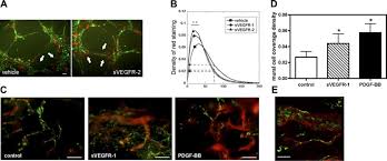 Jun 21, 2021 · the minister has signalled there will be a review of the smc (skilled migrant category) to ensure it is meeting new zealand's needs, the spokesperson said. Effect Of Svegfr 1 And 2 On Pc Smc Recruitment A Photomicrographs Of Download Scientific Diagram