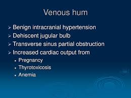 Image result for Venous Hum