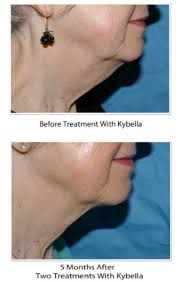 Maybe you would like to learn more about one of these? Treatments To Make Your Neck Look Younger Without Surgery Dermatology Consultants