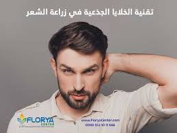تقنية الخلايا الجذعية في زراعة الشعر تعتبر تقنية الخلايا الجذعية في زراعة الشعر من أفضل الحلول التي ظهرت بمجال زراعة الشعر حيث حلت العديد من مشاكل التساقط بل