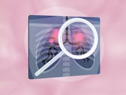 We did not find results for: Asthma And Coronavirus Does Asthma Increase Your Risk For Severe Covid 19 Symptoms Self