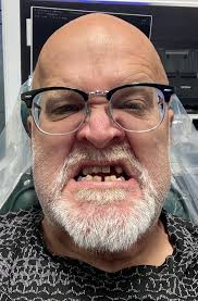 Recovery and experience with surgery