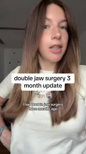Double Jaw Surgery 3 Month Update: Recovery & Storytime