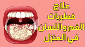 Pin On في العيادة Filel3yada