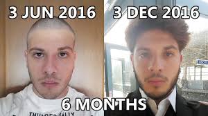 And depending on your genes, your hair could grow much faster. Top Hair Growth Time Lapse 6 Months Youtube