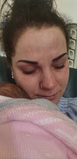 Tre måneder gamle Selina ble født uten nesten hele venstre hjernehalvdel.  Legene sa hun ville dø