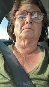 What skincare products for sun damage?