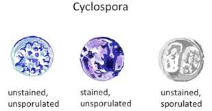 Image result for Cyclospora