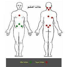 فوائد الحجامة لالتهابات الرحم مدينة الرياض