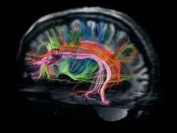 On the right, we see a normal brain scan with no signs of cte next to tom's brain where tau deposits, possible markers of cte. What Is A Cte Scan Brain Fitness Centers Of Florida