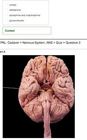 The critical point at which a stimulus causes an action potential. Nervous System Quiz Anatomy Anatomy Drawing Diagram