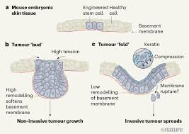 They don't form solid tumours. How Cancer Invasion Takes Shape