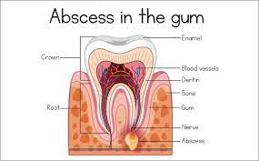 Rochedale Central Dentist Dental Services Dentist Restorative Dentistry