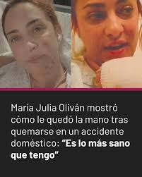 https://ow.ly/vsxr50Wi3f6 María Julia Oliván mostró cómo le quedó la mano  tras quemarse en un accidente doméstico: “Es lo más sano que tengo”