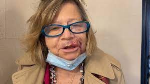 Random Assaults On Strangers Put New Yorkers On Edge With Attacks Increasing Even In Broad Daylight Daily Mail Online