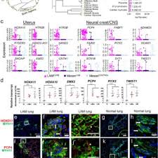 A coat of arms is also sometimes called a: David J Kwiatkowski S Research Works Harvard Medical School Ma Hms And Other Places