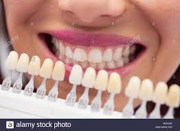 Dentist Shade Teeth Stock Photos Dentist Shade Teeth Stock