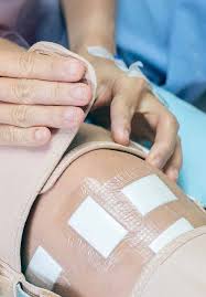 She captures people and events in a candid and unobtrusive fashion and is well known for her contemporary portraits as well as her lifestyle images. Orthoses Development Using Modern Technologies Intechopen