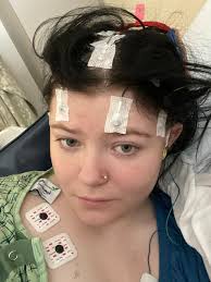 Living with epilepsy and seeking support