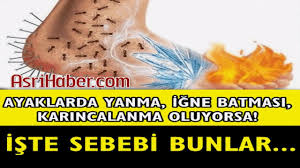 Ayaklarda Yanma Igne Batmasi Karincalanma Oluyorsa Iste Sebepleri Bunlar Youtube Saglik Dogal Saglik Youtube