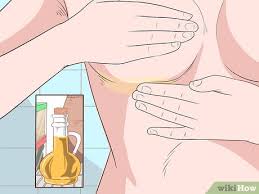 Image result for heat rash under breasts