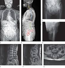 By dr arun pal singh. Https Www Ryanmiyamotomd Com Pdf Differentiating Hip Pathology From Lumbar Spine Pdf