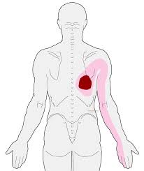 Pin On Pain Spine