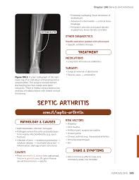 Image result for Septic Joint