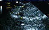 The american veterinary medical association (avma) reports that one in four dogs will develop cancer at some time in their life and that 50% of pets over the age of 10 will develop cancer. Testicular Cancer Remains Easily Preventable Disease