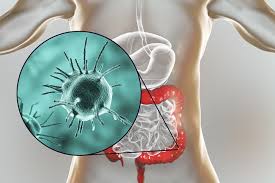 Lo Que Comes Puede Infestarte De Parasitos Intestinales