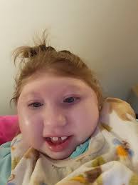 Olivia-Elise: A Journey of Unconditional Love in the Face of Anencephaly