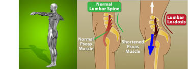 Check spelling or type a new query. Psoas Hip Flexors Home Facebook