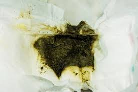 Durchfall Bei Baby Und Kleinkind Ursachen Und Tipps