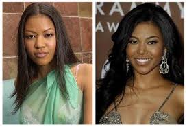 Celebrity Plastic Surgery Noses Lips And Face Lifts In 2020 Celebrity Plastic Surgery Plastic Surgery Nose Job