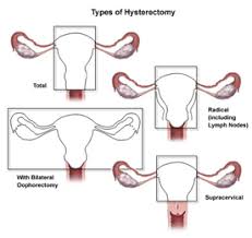 If a cyst ruptures, it can cause sudden, severe pain. What Risks Are Associated With A Ruptured Ovarian Cyst Johns Hopkins Medicine