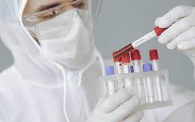 1.9k likes · 60 talking about this. Breaking Nou Record 799 De InfectÄƒri Cu Covid DupÄƒ 18 986 De Teste 17 PacienÈ›i Au Murit