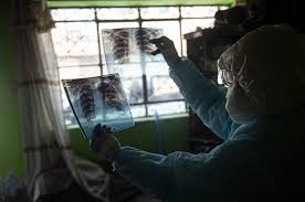 The calculus of variations is a field of mathematical analysis that uses variations, which are small changes in functions and functionals, to find maxima and minima of functionals: Zadqv2biy14mhm