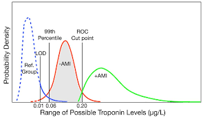 a brief review of troponin testing for clinicians american