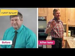 وداعا مرض السكر عن تجربة 100 Youtube Button Down Shirt Mens Tops Men Casual