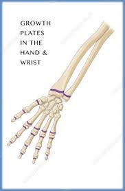 Image result for Hand Growth Plates